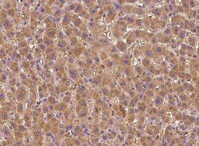 Immunohistochemistry-Paraffin: ERN2 Antibody [NBP3-05980] - Staining of human ERN2 in human liver with rabbit polyclonal antibody at 1:100 dilution.
