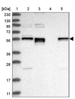 Western Blot: ERO1LB Antibody [NBP1-83961] - Lane 1: Marker  [kDa] 230, 130, 95, 72, 56, 36, 28, 17, 11.  Lane 2: Human cell line RT-4.  Lane 3: Human cell line U-251MG sp.  Lane 4: Human plasma (IgG/HSA depleted).  Lane 5: Human liver tissue