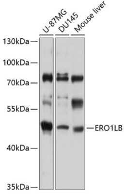 Western Blot: ERO1LB Antibody [NBP3-04975] - Analysis of extracts of various cell lines, using ERO1LB antibody at 1:1000 dilution. Secondary antibody: HRP Goat Anti-Rabbit IgG (H+L) at 1:10000 dilution. Lysates/proteins: 25ug per lane. Blocking buffer: 3% nonfat dry milk in TBST. Detection: ECL Basic Kit