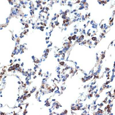 Immunohistochemistry-Paraffin: ERP29 Antibody (1J0D3) [NBP3-15906] - Immunohistochemistry of paraffin-embedded rat lung using ERP29 Rabbit mAb (NBP3-15906) at dilution of 1:100 (40x lens).Perform microwave antigen retrieval with 10 mM Tris/EDTA buffer pH 9.0 before commencing with IHC staining protocol.