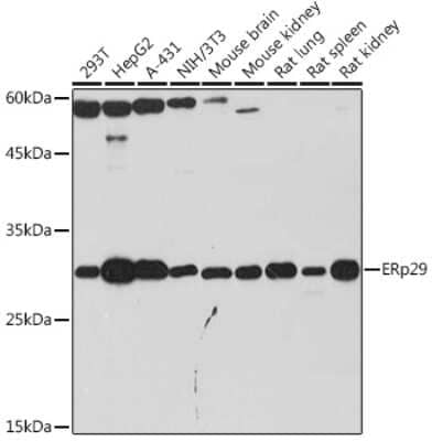 Western Blot: ERP29 Antibody (1J0D3) [NBP3-15906] - Western blot analysis of extracts of various cell lines, using ERP29 Rabbit mAb (NBP3-15906) at 1:1000 dilution. Secondary antibody: HRP Goat Anti-Rabbit IgG (H+L) at 1:10000 dilution. Lysates/proteins: 25ug per lane. Blocking buffer: 3% nonfat dry milk in TBST. Detection: ECL Basic Kit. Exposure time: 180s.