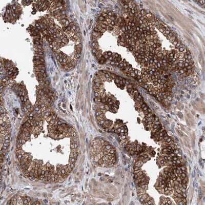 Immunohistochemistry-Paraffin: ERP29 Antibody [NBP1-88395] - Staining of human prostate shows high expression.