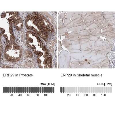 <b>Orthogonal Strategies Validation. </b>Immunohistochemistry-Paraffin: ERP29 Antibody [NBP1-88395] - Staining in human prostate and skeletal muscle tissues using anti-ERP29 antibody. Corresponding ERP29 RNA-seq data are presented for the same tissues.