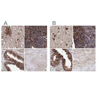 <b>Independent Antibodies Validation. </b>Immunohistochemistry-Paraffin: ERP29 Antibody [NBP1-88395] - Staining of human cerebral cortex, lymph node, prostate and skeletal muscle using Anti-ERP29 antibody NBP1-88395 (A) shows similar protein distribution across tissues to independent antibody NBP1-88396 (B).