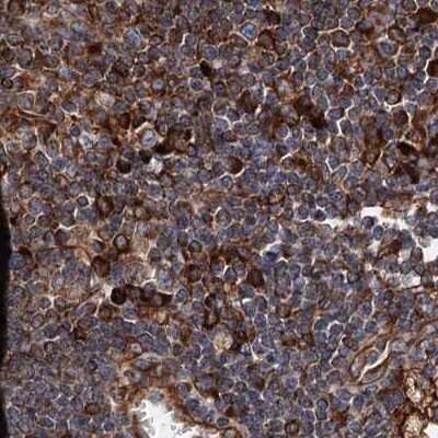 Immunohistochemistry-Paraffin: ERP29 Antibody [NBP1-88395] - Staining of human lymph node.