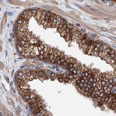 Immunohistochemistry-Paraffin: ERP29 Antibody [NBP1-88395] - Staining of human prostate using Anti-ERP29 antibody NBP1-88395.