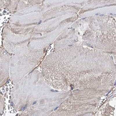 <b>Independent Antibodies Validation. </b>Immunohistochemistry-Paraffin: ERP29 Antibody [NBP1-88395] - Staining of human skeletal muscle using Anti-ERP29 antibody NBP1-88395.