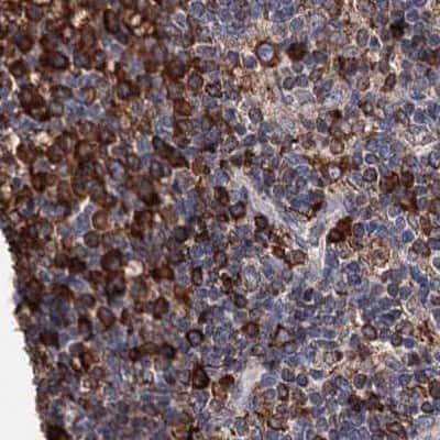 Immunohistochemistry-Paraffin: ERP29 Antibody [NBP1-88396] - Staining of human lymph node.