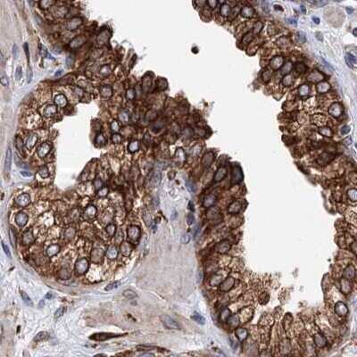 Immunohistochemistry-Paraffin: ERP29 Antibody [NBP1-88396] - Staining of human prostate using Anti-ERP29 antibody NBP1-88396.