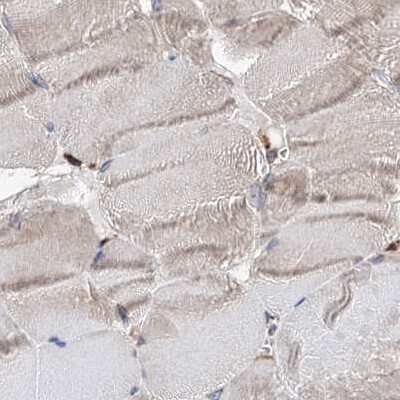 Immunohistochemistry-Paraffin: ERP29 Antibody [NBP1-88396] - Staining of human skeletal muscle using Anti-ERP29 antibody NBP1-88396.