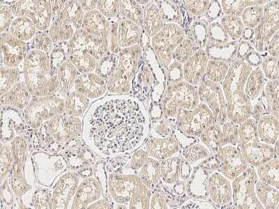 Immunohistochemistry-Paraffin: ERP29 Antibody [NBP2-99200] - Immunochemical staining of human ERP29 in human liver with rabbit polyclonal antibody (1:1000, formalin-fixed paraffin embedded sections).