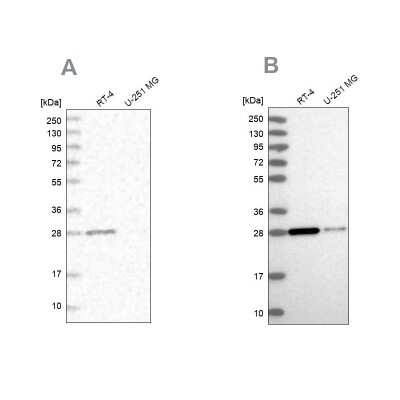 Western Blot: ERP29 Antibody [NBP1-88395] - Analysis using Anti-ERP29 antibody NBP1-88395 (A) shows similar pattern to independent antibody NBP1-88396 (B).