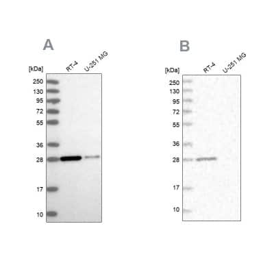 <b>Independent Antibodies Validation. </b>Western Blot: ERP29 Antibody [NBP1-88396] - Analysis using Anti-ERP29 antibody NBP1-88396 (A) shows similar pattern to independent antibody NBP1-88395 (B).