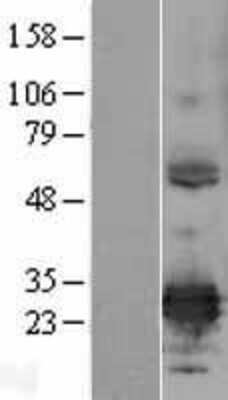 Western Blot: ERP29 Overexpression Lysate (Adult Normal) [NBL1-10338] Left-Empty vector transfected control cell lysate (HEK293 cell lysate); Right -Over-expression Lysate for ERP29.