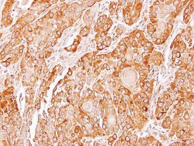 Immunohistochemistry-Paraffin: ERP44 Antibody [NBP1-32495] - Paraffin-embedded SCC4 xenograft, using antibody at 1:100 dilution.