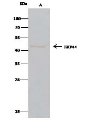 Immunoprecipitation: ERP44 Antibody [NBP2-97000] - ERP44 was immunoprecipitated using: Lane A: 0.5 mg Raji Whole Cell Lysate. 2 ul anti-ERP44 rabbit polyclonal antibody and 60 ug of Immunomagnetic beads. Protein G. Primary antibody: Anti-ERP44 rabbit polyclonal antibody, at 1:100 dilution. Secondary antibody: Clean-Bloto IP Detection Reagent (HRP) at 1:500 dilution. Developed using the DAB staining technique. Performed under reducing conditions. Predicted band size: 47 kDa. Observed band size: 47 kDa