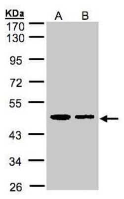 Western Blot: ERP44 Antibody [NBP1-32495] - (30 ug whole cell lysate) A:A431 B:H1299 10% SDS PAGE diluted at 1:1000