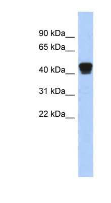 Western Blot: ERP44 Antibody [NBP1-56623] - Human Placenta lysate, concentration 0.2-1 ug/ml.