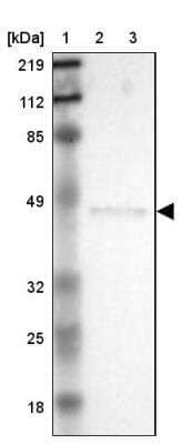 Western Blot: ERP44 Antibody [NBP1-89617] - Lane 1: Marker  [kDa] 219, 112, 85, 49, 32, 25, 18.   Lane 2: Human cell line RT-4.  Lane 3: Human cell line U-251MG sp