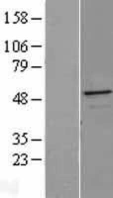 Western Blot: ERP44 Overexpression Lysate (Adult Normal) [NBL1-17471] Left-Empty vector transfected control cell lysate (HEK293 cell lysate); Right -Over-expression Lysate for ERP44.