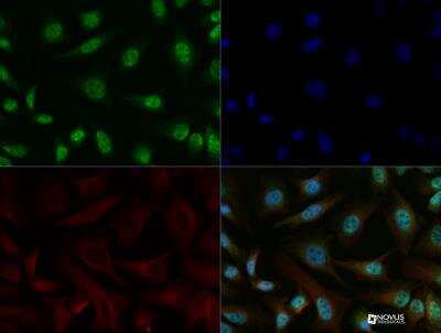 Immunocytochemistry/Immunofluorescence: ERR alpha/NR3B1 Antibody [NBP1-47254] - ERR alpha antibody was tested in HeLa cells at a 1:100 dilution against Dylight 488 (Green). Alpha tubulin and nuclei were counterstained against Dylight 568 (Red) and DAPI (Blue), respectively.