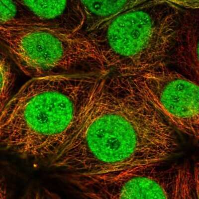 Immunocytochemistry/Immunofluorescence: ERR alpha/NR3B1 Antibody [NBP2-56812] - Staining of human cell line MCF7 shows localization to nucleus, nucleoli fibrillar center, microtubules & cytokinetic bridge.