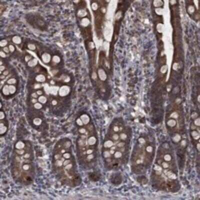 Immunohistochemistry-Paraffin: ERR alpha/NR3B1 Antibody [NBP3-17645] - Staining of human small intestine shows strong cytoplasmic positivity in glandular cells.