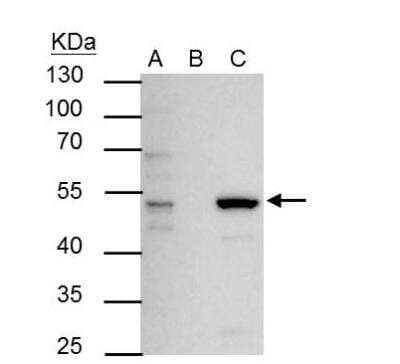 Immunoprecipitation: ERR alpha/NR3B1 Antibody [NBP2-16380] - IP Sample: 293T whole cell lysate/extract A : 30 ug whole cell lysate/extract of ERR alpha protein expressing 293T cells B : Control with 2.5 ug of pre-immune rabbit IgG C : Immunoprecipitation of ERR alpha by 2.5 ug of ERR alpha antibody 10% SDS-PAGE The immunoprecipitated ERR alpha protein was detected by ERR alpha antibody diluted at 1 : 1000. EasyBlot anti-rabbit IgG (HRP) was used as a secondary eagent.