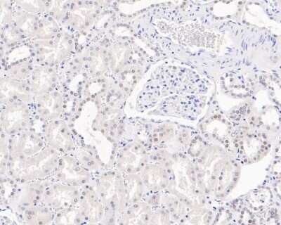Immunohistochemistry-Paraffin: ERR alpha/NR3B1 Antibody (SC57-07) [NBP2-67556] - Flow cytometric analysis of Hela cells with Estrogen Related Receptor alpha antibody at 1/50 dilution (red) compared with an unlabelled control (cells without incubation with primary antibody; black). Alexa Fluor 488-conjugated goat anti rabbit IgG was used as the secondary antibody.