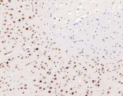 Immunohistochemistry-Paraffin: ERR alpha/NR3B1 Antibody (SC57-07) [NBP2-67556] - Analysis of paraffin-embedded mouse brain tissue using anti-Estrogen Related Receptor alpha antibody. The section was pre-treated using heat mediated antigen retrieval with Tris-EDTA buffer (pH 8.0-8.4) for 20 minutes.The tissues were blocked in 5% BSA for 30 minutes at room temperature, washed with ddH2O and PBS, and then probed with the primary antibody (1/200) for 30 minutes at room temperature. The detection was performed using an HRP conjugated compact polymer system. DAB was used as the chromogen. Tissues were counterstained with hematoxylin and mounted with DPX.