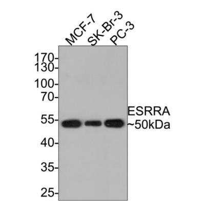 Western Blot: ERR alpha/NR3B1 Antibody (SC57-07) [NBP2-67556] - Analysis of Estrogen Related Receptor alpha on different lysates with Rabbit anti-Estrogen Related Receptor alpha antibody at 1/500 dilution. Lane 1: MCF-7 cell lysateLane 2: SK-Br-3 cell lysateLane 3: PC-3 cell lysateLysates/proteins at 10 ug/Lane. Predicted band size: 46 kDa Observed band size: 50 kDa, Exposure time: 2 minutes; 10% SDS-PAGE gel. Proteins were transferred to a PVDF membrane and blocked with 5% NFDM/TBST for 1 hour at room temperature. The primary antibody at 1/500 dilution was used in 5% NFDM/TBST at room temperature for 2 hours. Goat Anti-Rabbit IgG - HRP Secondary Antibody at 1:200,000 dilution was used for 1 hour at room temperature.