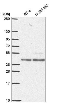 Western Blot: ERR alpha/NR3B1 Antibody [NBP2-56812] - Western blot analysis in human cell line RT-4 and human cell line U-251 MG.