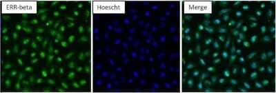 Immunocytochemistry/Immunofluorescence: ERR beta/NR3B2 Antibody [NB300-748] - Analysis of Estrogen Related Receptor beta (green) in NRK cells. Formalin-fixed cells were permeabilized with 0.1% Triton X-100 in TBS for 10 minutes at room temperature and blocked with 5% normal goat serum for 15 minutes at room temperature. Cells were probed with a Estrogen Related Receptor beta polyclonal antibody at a dilution of 1:100 for at least 1 hour at room temperature, washed with PBS, and incubated with DyLight 488-conjugated goat anti-rabbit IgG secondary antibody at a dilution of 1:400 for 30 minutes at room temperature. Nuclei (blue) were stained with Hoechst 33342 dye.