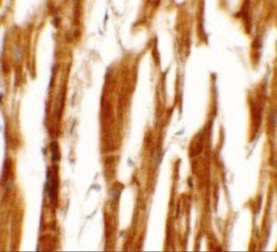 Immunohistochemistry: ERR beta/NR3B2 Antibody [NBP2-81824] - Immunohistochemistry of ERR beta/NR3B2 in human heart tissue with ERR beta/NR3B2 antibody at 5 ug/mL.