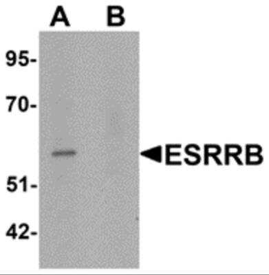 Western Blot: ERR beta/NR3B2 Antibody [NBP2-81824] - Analysis of ERR beta/NR3B2 in human heart tissue lysate with ERR beta/NR3B2 antibody at 1 ug/ml in (A) the absence and (B) the presence of blocking peptide.