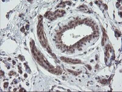 Immunohistochemistry: ERR gamma/NR3B3 Antibody (1E5) [NBP2-45698] - Analysis of Human breast tissue.