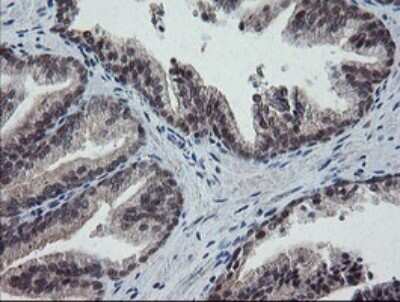 Immunohistochemistry: ERR gamma/NR3B3 Antibody (1E5) [NBP2-45698] - Analysis of Human prostate tissue.