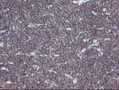 Immunohistochemistry: ERR gamma/NR3B3 Antibody (1E5) [NBP2-45698] - Analysis of Human tonsil tissue.