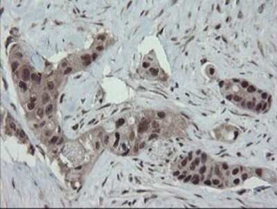 Immunohistochemistry: ERR gamma/NR3B3 Antibody (1E5) [NBP2-45698] - Analysis of Human colon tissue.