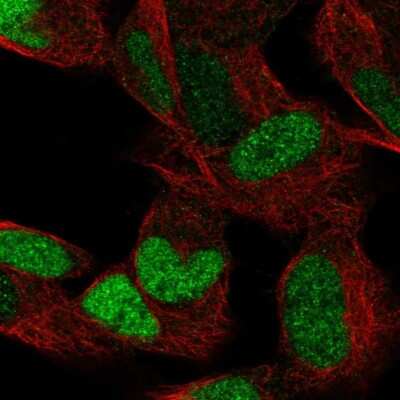 Immunocytochemistry/Immunofluorescence: ERR gamma/NR3B3 Antibody [NBP1-91873] - Immunofluorescent staining of human cell line SH-SY5Y shows localization to nucleus.