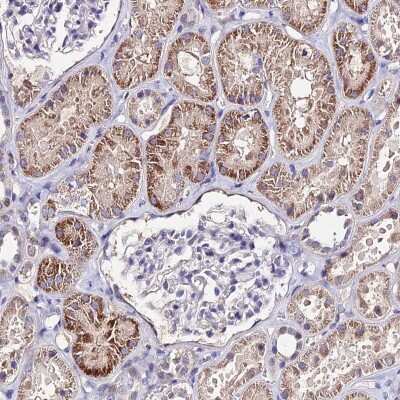 Immunohistochemistry-Paraffin: ERR gamma/NR3B3 Antibody [NBP1-91873] - Staining of human kidney shows moderate cytoplasmic positivity in cells in tubules.