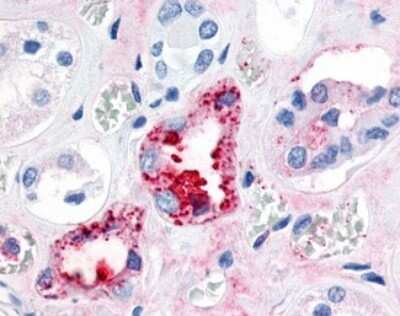 Immunohistochemistry-Paraffin: ERR gamma/NR3B3 Antibody [NLS2400] - Analysis of anti-ERR Gamma antibody with human kidney, diabetes.