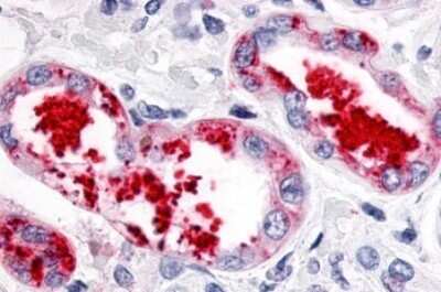 Immunohistochemistry-Paraffin: ERR gamma/NR3B3 Antibody [NLS5960] - Anti-ESRRG / ERR Gamma antibody IHC of human kidney, diabetes. Immunohistochemistry of formalin-fixed, paraffin-embedded tissue after heat-induced antigen retrieval.