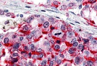 Immunohistochemistry-Paraffin ERR gamma/NR3B3 Antibody - BSA Free