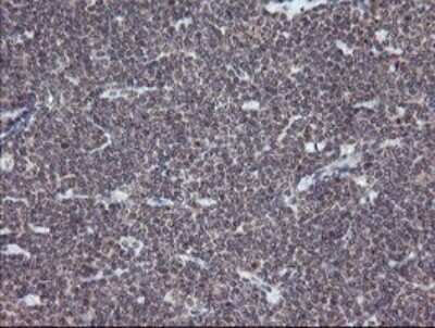 Immunohistochemistry: ERR gamma/NR3B3 Antibody (OTI1E5) - Azide and BSA Free [NBP2-70691] - Analysis of Human tonsil tissue.
