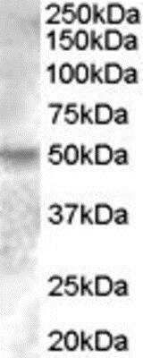 Western Blot: ERR gamma/NR3B3 Antibody [NBP1-00182] -  (0.2ug/ml) staining of Human Breast lysate (35ug protein in RIPA buffer). Primary incubation was 1 hour. Detected by chemiluminescence.