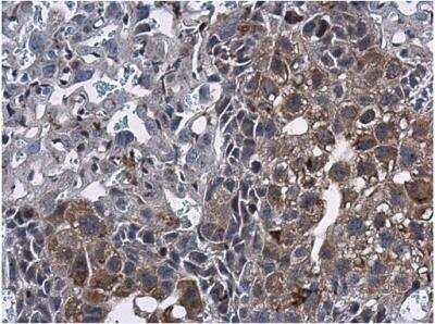 Immunohistochemistry-Paraffin ERRFI1 Antibody