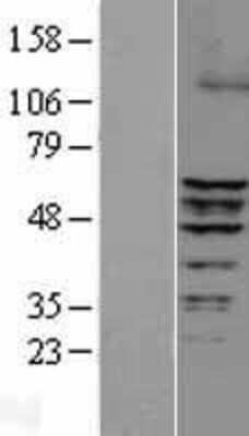 Western Blot: ERRFI1 Overexpression Lysate (Adult Normal) [NBL1-10339] Left-Empty vector transfected control cell lysate (HEK293 cell lysate); Right -Over-expression Lysate for ERRFI1.