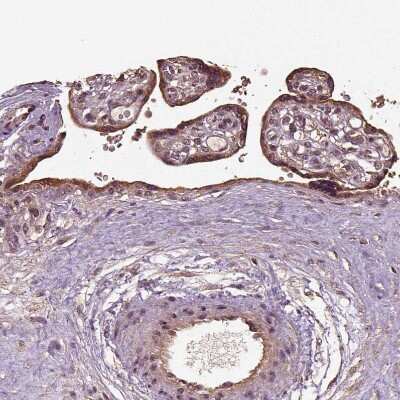 Immunohistochemistry-Paraffin: ERV3-1 Antibody [NBP2-62602] - Staining of human placenta shows moderate cytoplasmic positivity in trophoblastic cells.