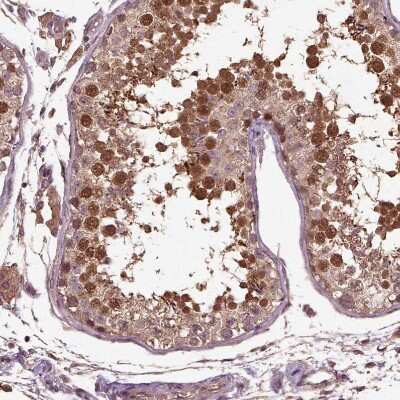 Immunohistochemistry-Paraffin: ERV3-1 Antibody [NBP2-62602] - Staining of human testis shows moderate to strong cytoplasmic positivity in cells in seminiferous ducts.
